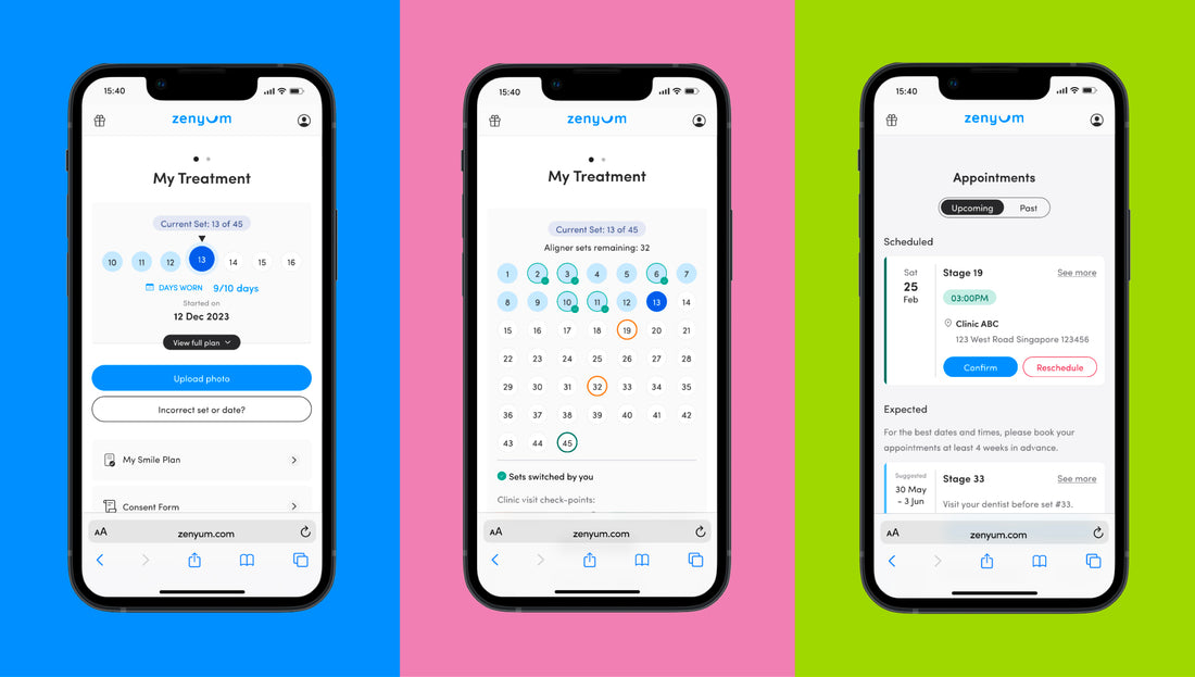 Your brand-new ZenyumClear™ Smile Journey is coming soon